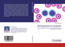 Buchcover von HLA Expression in Leukemia