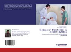 Bookcover of Incidence of Brain Lesions in Saudi Population