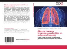 Bookcover of Atlas de cuerpos ferruginosos retenidos en pulmones humanos