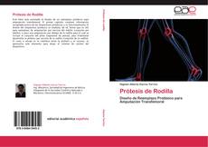 Capa do livro de Prótesis de Rodilla 