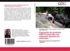 Capa do livro de Expresión de proteína HSP70 inducida con radiación gamma en linfocitos 