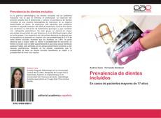 Bookcover of Prevalencia de dientes incluidos