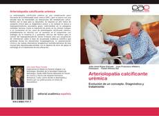 Capa do livro de Arteriolopatía calcificante urémica 