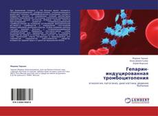 Buchcover von Гепарин-индуцированная тромбоцитопения