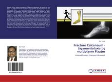 Bookcover of Fracture Calcaneum - Ligamentotaxis by multiplaner Fixator