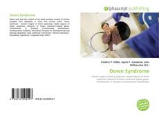 Bookcover of Down Syndrome