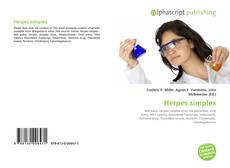 Bookcover of Herpes simplex