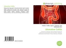 Bookcover of Ulcerative Colitis
