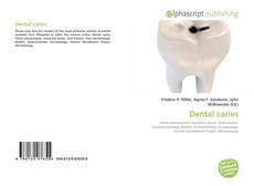 Bookcover of Dental caries