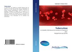 Couverture de Tuberculose