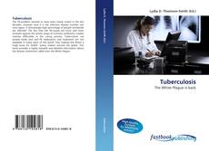 Portada del libro de Tuberculosis