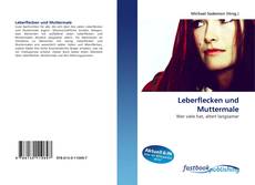 Couverture de Leberflecken und Muttermale