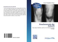 Couverture de Knochenersatz der Zukunft