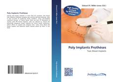 Buchcover von Poly Implants Prothèses
