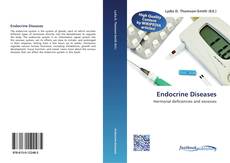 Bookcover of Endocrine Diseases