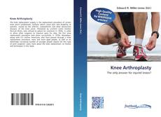 Bookcover of Knee Arthroplasty