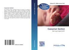 Bookcover of Caesarian Section