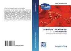 Bookcover of Infections sexuellement transmissibles