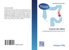 Bookcover of Cancer du côlon