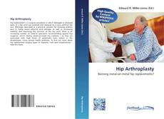 Bookcover of Hip Arthroplasty