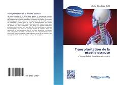 Bookcover of Transplantation de la moelle osseuse