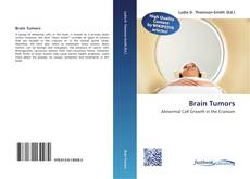 Bookcover of Brain Tumors