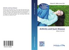 Buchcover von Arthritis and Gum Disease