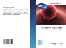 Bookcover of Cancer de la prostate