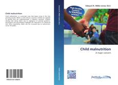 Buchcover von Child malnutrition