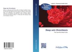 Buchcover von Deep vein thrombosis