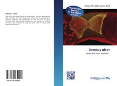 Bookcover of Venous ulcer