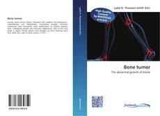 Bookcover of Bone tumor