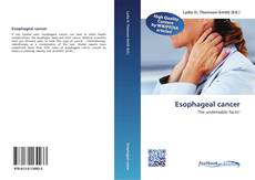 Buchcover von Esophageal cancer