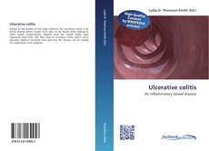 Bookcover of Ulcerative colitis