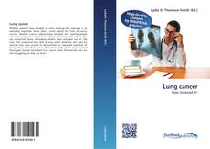 Bookcover of Lung cancer