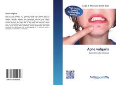 Buchcover von Acne vulgaris