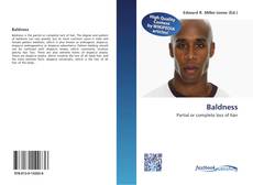 Bookcover of Baldness