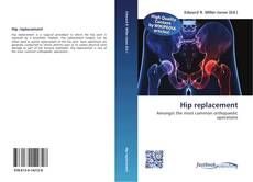 Buchcover von Hip replacement