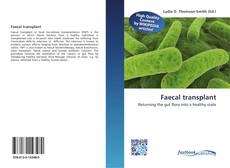 Buchcover von Faecal transplant