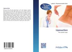 Buchcover von Liposuction