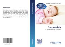 Bookcover of Brachycephaly