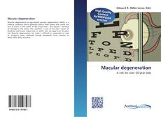 Bookcover of Macular degeneration