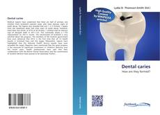 Capa do livro de Dental caries 