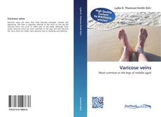 Bookcover of Varicose veins