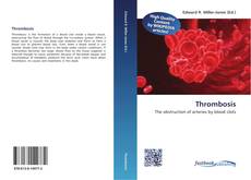 Bookcover of Thrombosis