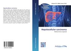 Capa do livro de Hepatocellular carcinoma 