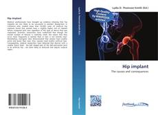 Bookcover of Hip implant