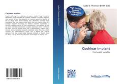 Bookcover of Cochlear implant