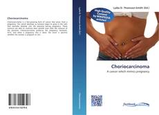 Buchcover von Choriocarcinoma