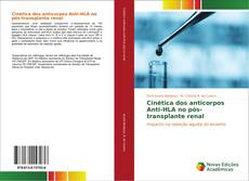 Cinética dos anticorpos Anti-HLA no pós-transplante renal kitap kapağı
